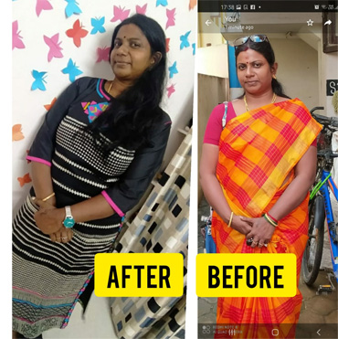 before-after