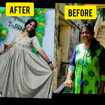 before-after